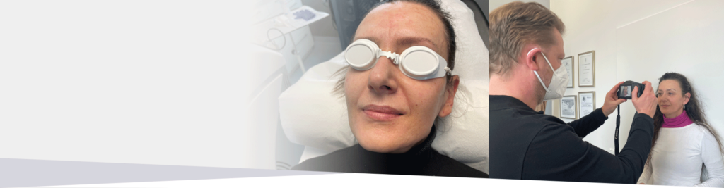 Gesichtsbehandlung mit dem Laser: Ein Patientenbericht zur Hautverjüngung mit dem Alma Lasers Pixel Co2 System